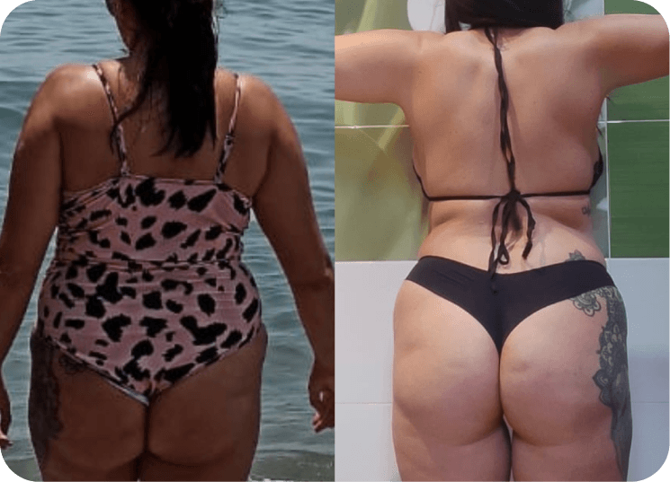 Transformación antes y después - vista espalda